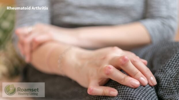 Rheumatoid Arthritis